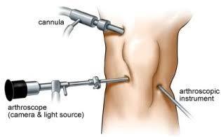 Arthroscopy doctors in Bangalore